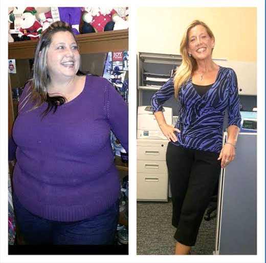 Alisa Hernandez before and after weight loss photo at McCarty Weight Loss Center