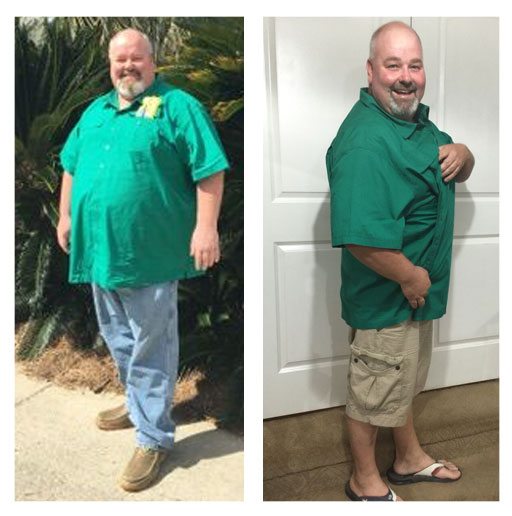 Chris Collins before and after weight loss photo at McCarty Weight Loss Center