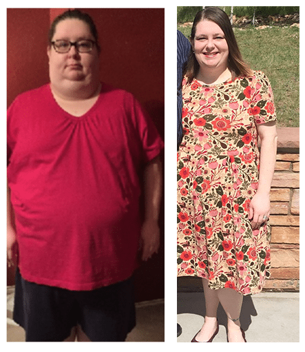 Weight Loss Patient of the Month