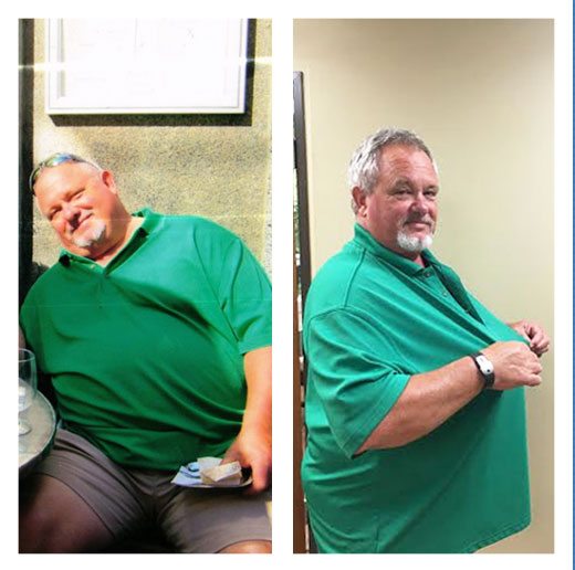 Keith Lawson before and after weight loss photo at McCarty Weight Loss Center
