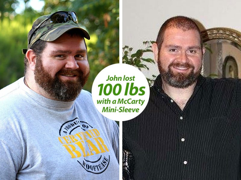 John before and after weight loss photo at McCarty Weight Loss Center