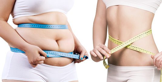 McCarty Weight Loss Center Dallas - Best Weight Loss Surgeon Dallas
