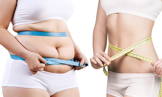 Weight Loss - Path to Success by Rex Bariatric Specialists